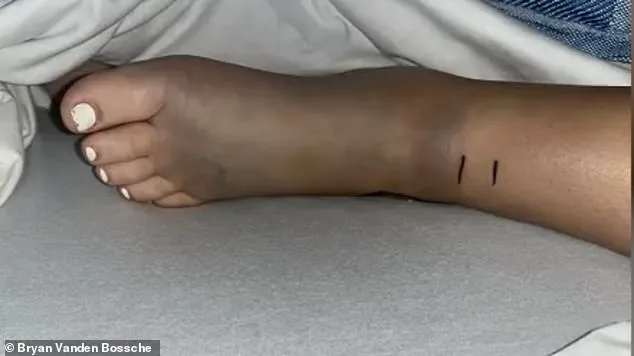 14-Year-Old California Girl Survives Critical Rattlesnake Bite During Mountain Bike Trip