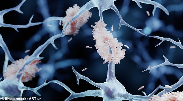 One Sleepless Night Can Trigger Brain Damage Mimicking Alzheimer's Symptoms