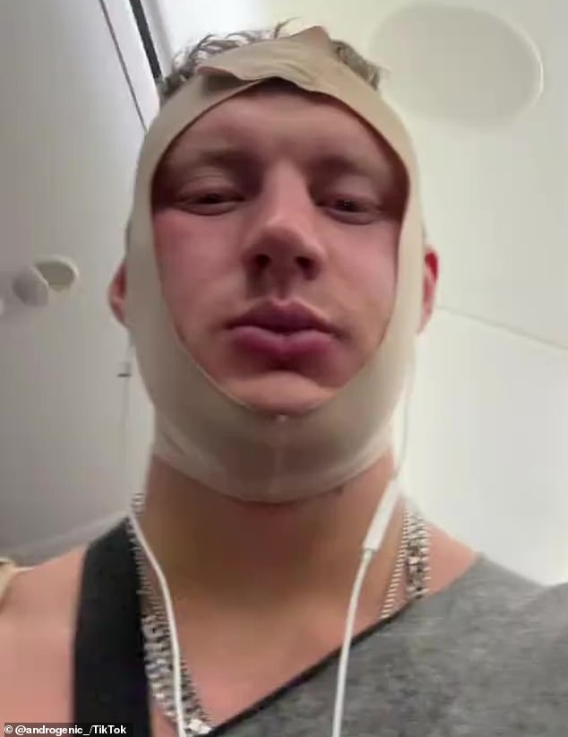 Streamer removed from flight after extreme cosmetic procedures caused confusion.