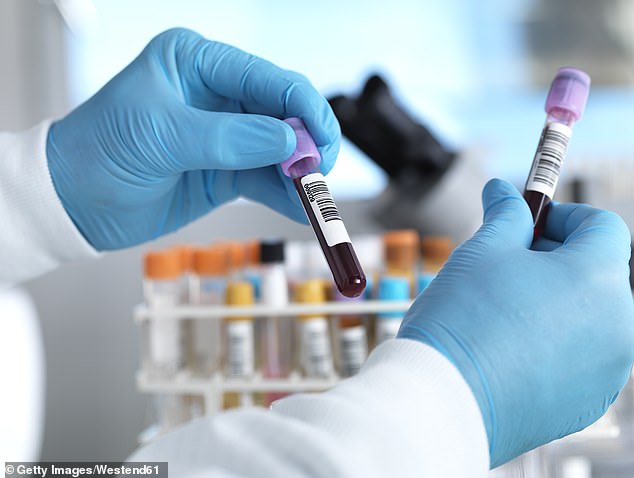 NHS back blood test could prevent one in five late-stage cancer deaths.